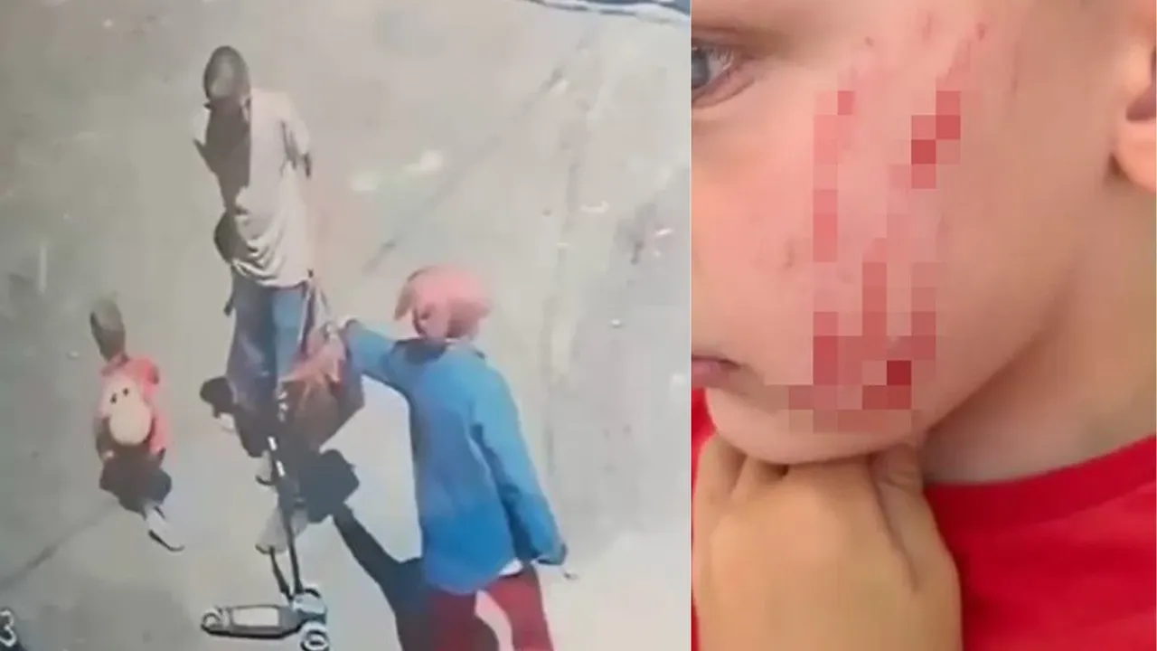 Van'da 4 yaşındaki çocuğa sokakta saldırı kamerada