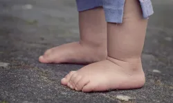 İlk kez obez çocuk sayısı zayıfların sayısından fazla