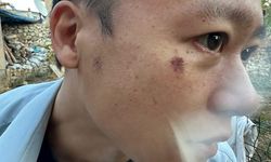 Yüksekova’da yabancı turist saldırıya uğradı