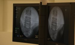 Fıtıkla uzun yaşam ciddi risk taşıyor