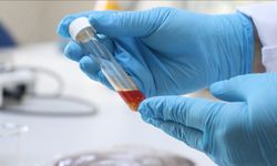 Tekirdağ’da üzüm atığından yüksek değerli yağ