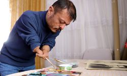 Dirsekleriyle çizdiği resimlerle hayata tutundu