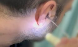 Kulağına gizlediği yasaklı maddeyle yakalandı