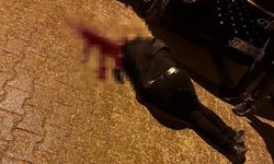 Sokakta yürürken tabanca ile başından vuruldu