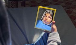 Protez gözle hayata tutunmayı umut ediyor