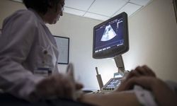 Her 10 kadından biri "çikolata kisti" ile yaşıyor