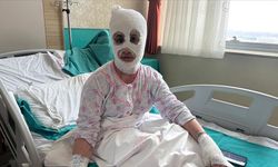 Patlayan düdüklü tencere iki çocuk annesini yaraladı