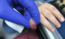 AVM’de feci olay: Çocuğun parmağı koptu