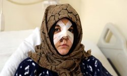 Kaldırım taşıyla saldırı: ‘silah’ sayıldı