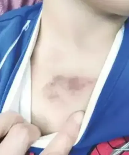 Kreşte çocuğa şiddet soruşturması