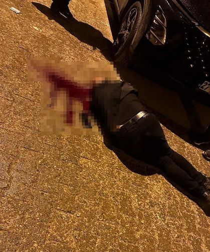 Sokakta yürürken tabanca ile başından vuruldu