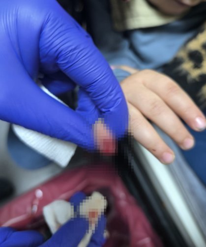 AVM’de feci olay: Çocuğun parmağı koptu