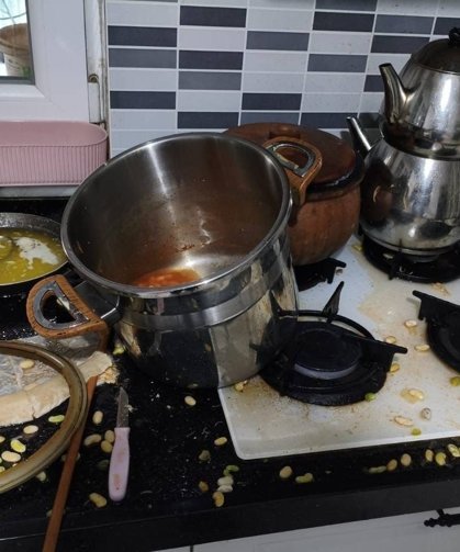 Düdüklü tencere patladı: 1 yaralı