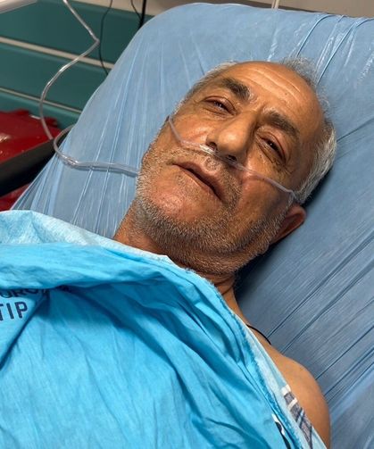 Kovanların bakımını yaparken arı saldırısında yaralandı