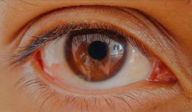 Göz tansiyonunda erken tanı görme kaybını önlüyor