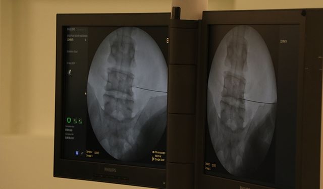 Fıtıkla uzun yaşam ciddi risk taşıyor