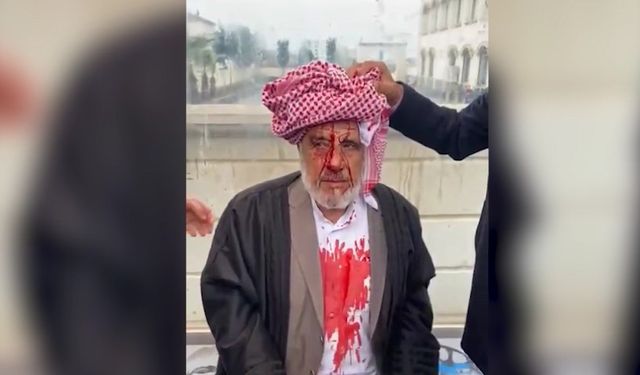 Şanlıurfa'da sopayla darba 4 tutuklama