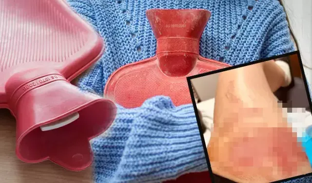 Hakkari’de sıcak su torbası patladı: Genç kadın yaralandı