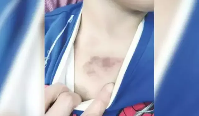 Kreşte çocuğa şiddet soruşturması