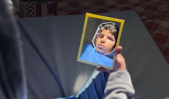 Protez gözle hayata tutunmayı umut ediyor