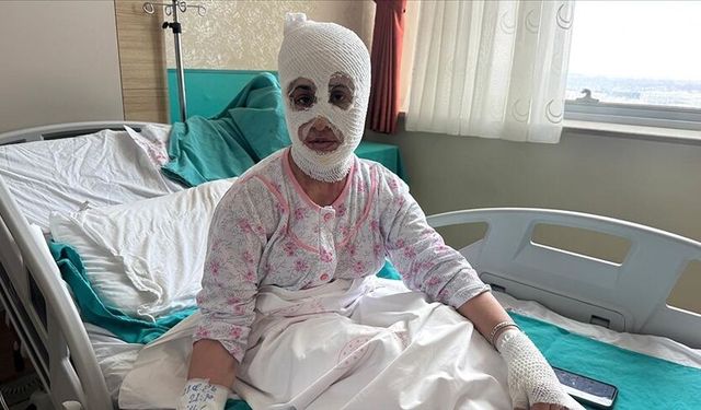 Patlayan düdüklü tencere iki çocuk annesini yaraladı