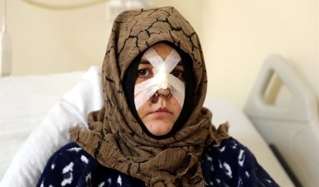 Kaldırım taşıyla saldırı: ‘silah’ sayıldı