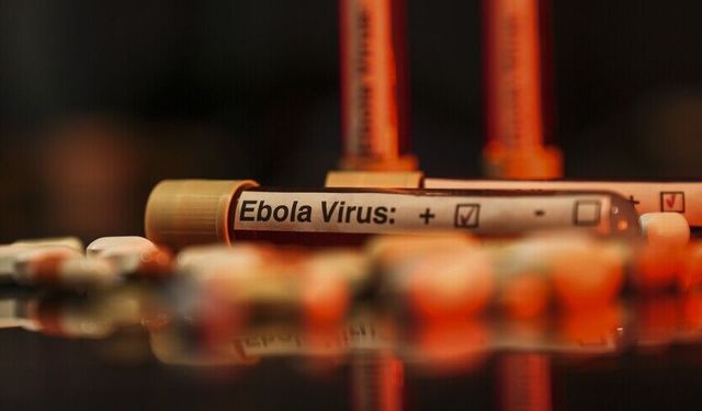 ABD’de havalimanlarına Ebola taraması kurulacak