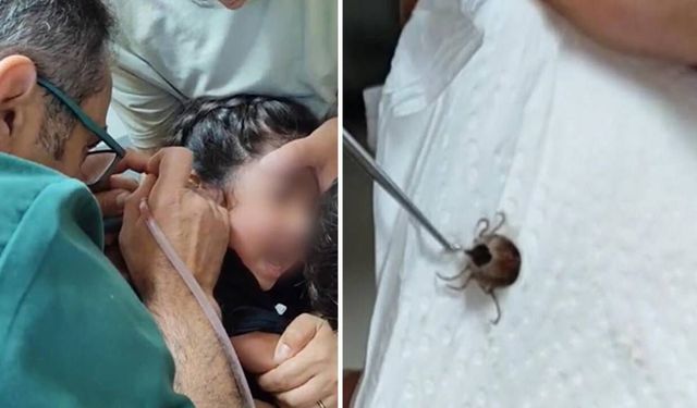 Çocuğun kulağından canlı kene çıkarıldı
