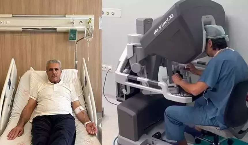 Mide kanserini robotik cerrahi ile yendi