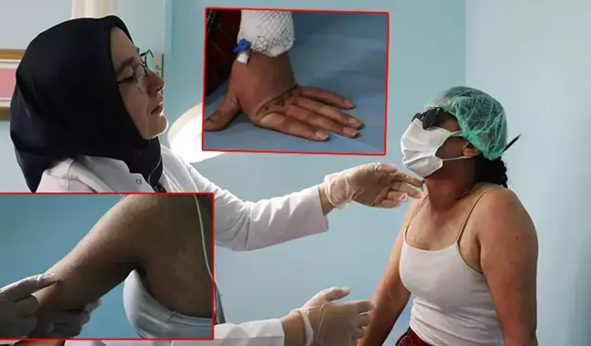 İnternetten sipariş verdiği krem hastanelik etti