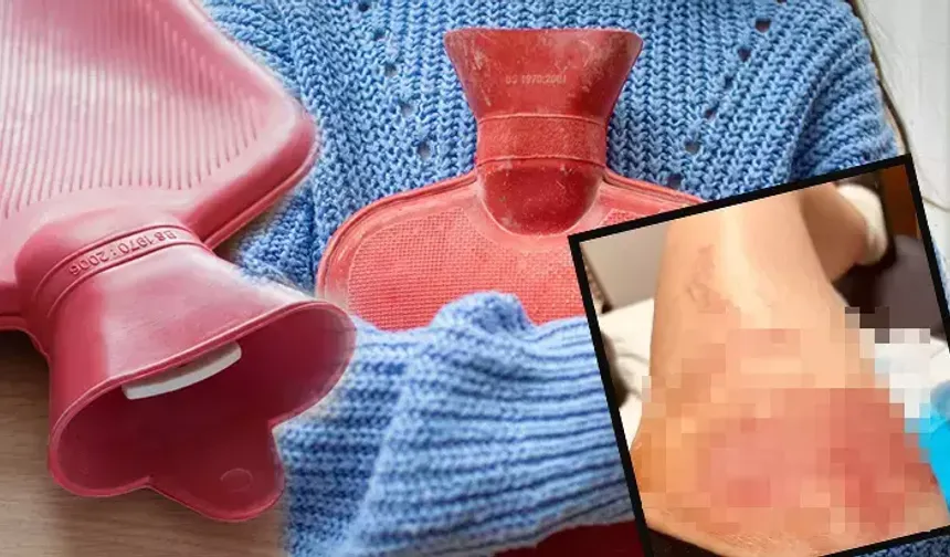 Hakkari’de sıcak su torbası patladı: Genç kadın yaralandı