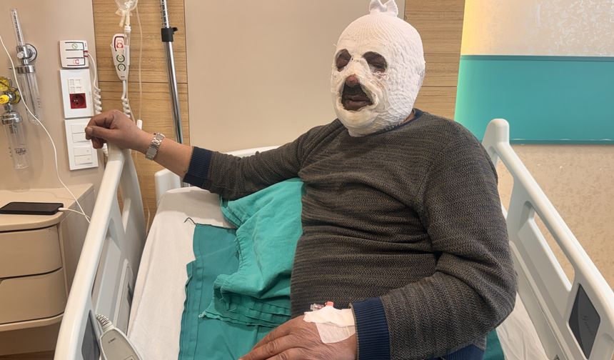 Kalorifer kazanında benzin faciası