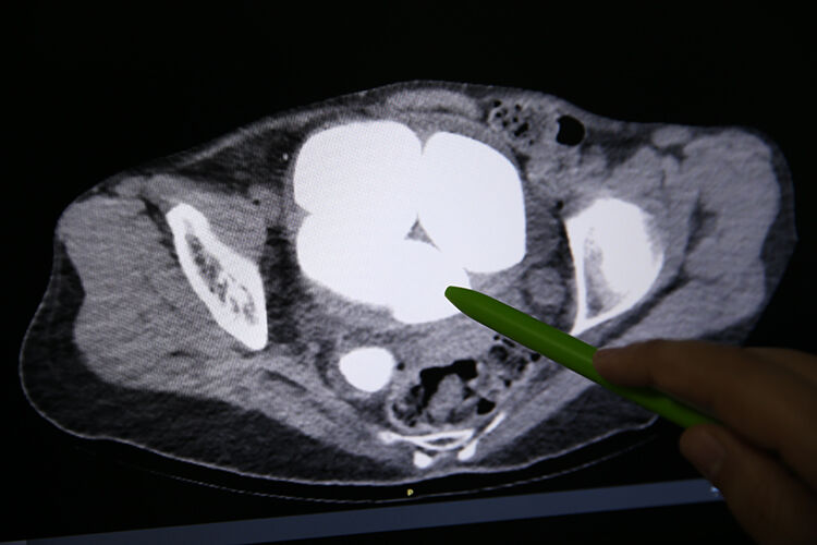 006 2026 10 Mart 15 Mart 12 20260331 2 73661908 123718876