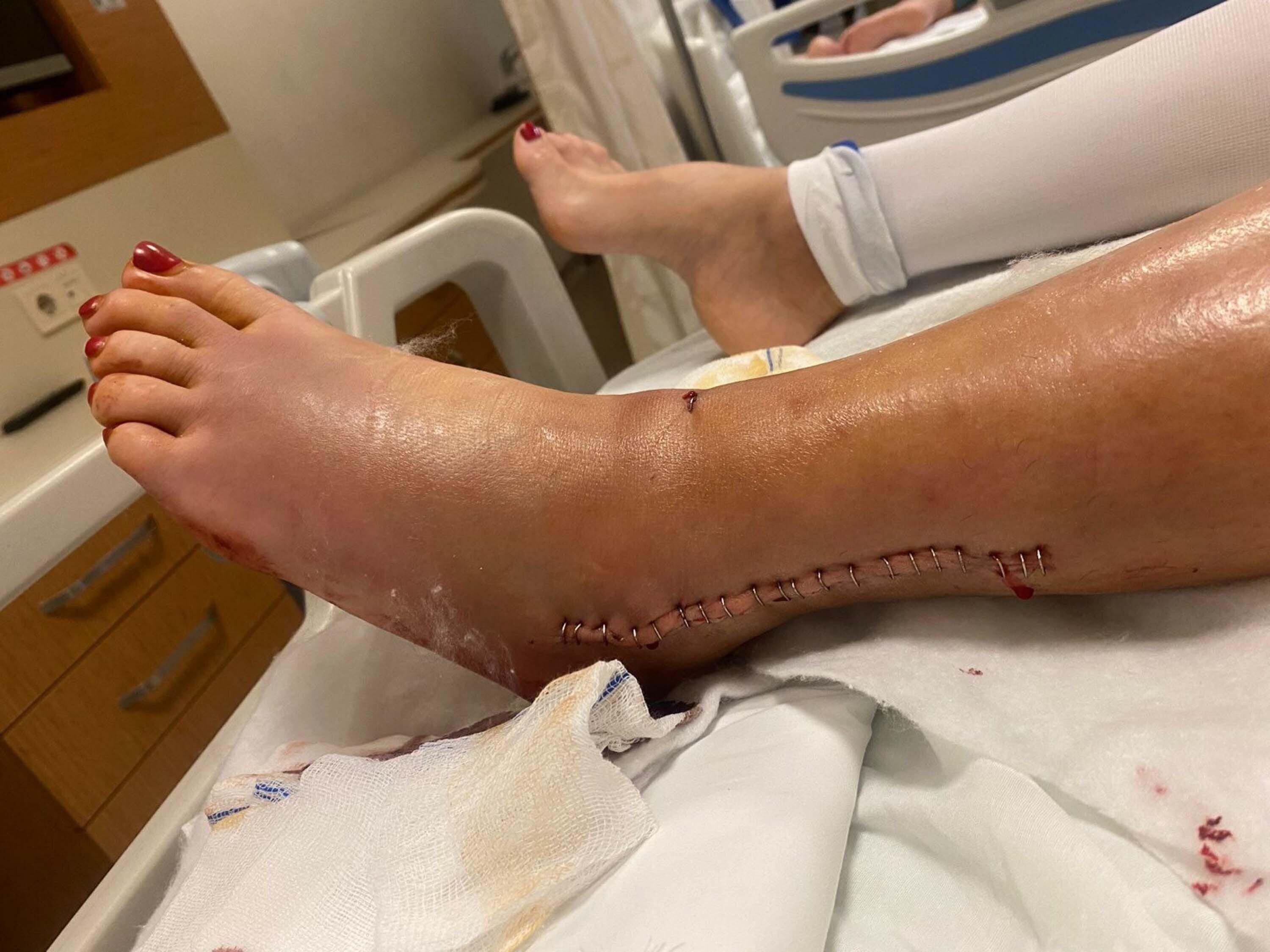 Hatice: Otomobille ezilmem kaza değildi